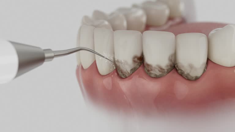 Trusted Teeth Cleaning And Checkup service in LaFayette, GA - Dentist Open Now